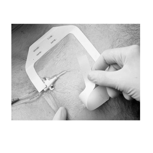 Frame Style Transparent Dressing, 4" x 4½" with Label, 50/bx, 4 bx/cs (Continental US+HI Only)