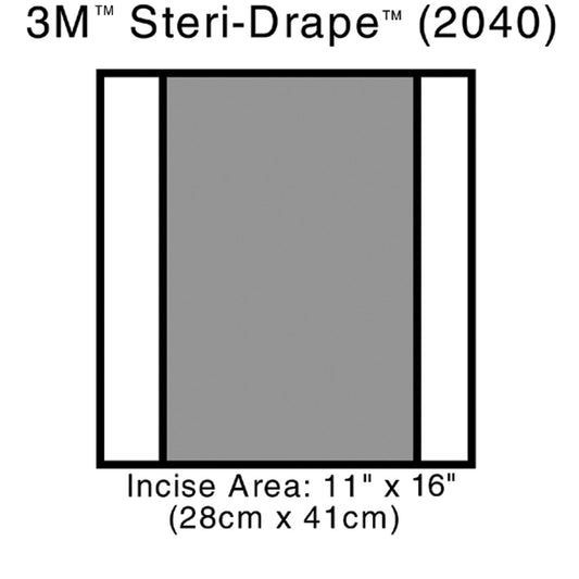 Incise Drape, Overall 14" x 16", Incise 11" x 16", 10/bx, 4 bx/cs (Continental US+HI Only)