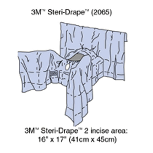 Steri-Drape™ Abdominal Perineal Drape with Incise Film, 160", Lithotomy Position, Absorbent Impervious Material, Incise Aperture, Perineal/ Vaginal Aperture, 4 Tube Organizer, 8/bx, 2 bx/cs (Continental US+HI Only)