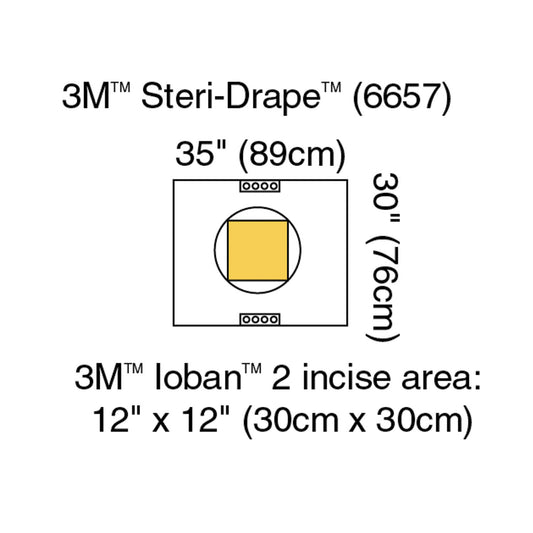 Cesarean-Section Pouch with Ioban™ 2 Incise Film, 35" x 30", 10/bx, 4 bx/cs (Continental US+HI Only)